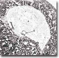 Photomicrograph of supension of an embryo (marked B) about 15 days old. Actual size 0.6 mm